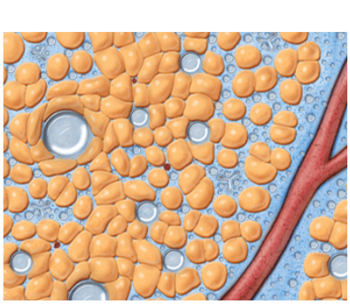 VASERlipo fragmentation